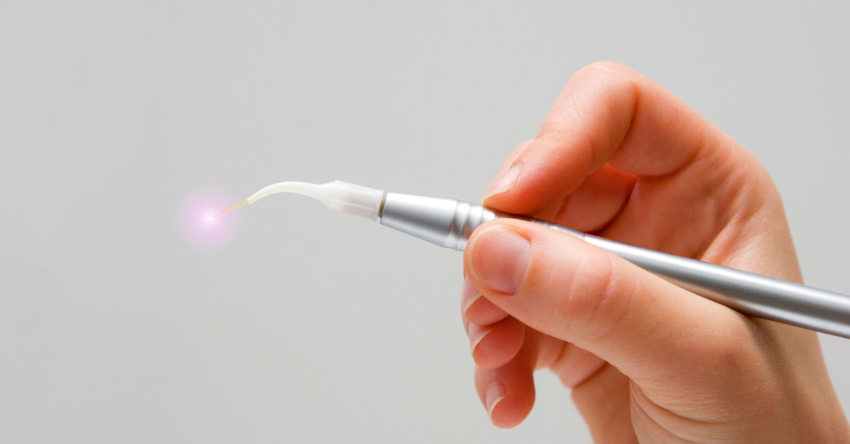 How to Use Lasers in Dentistry? 3 dental laser